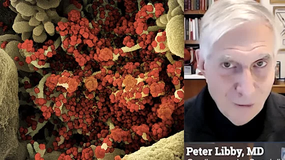 Peter Libby, MD, explains how infections cause heart attacks. This came out of research taking a close look at COVID, but the inflammation from any infection may cause increased inflammation of coronary plaques that cause heart attacks. #COVID #COVID19