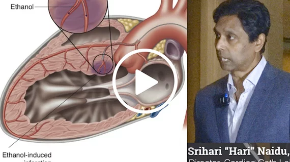 Video of Hari Naidu, MD, director of the Hypertrophic Cardiomyopathy Center of Excellence at Westchester Medical Center, explaining the role of alcohol septal ablation and surgical myectomy in the era of mavacamten. #HCM #ASE