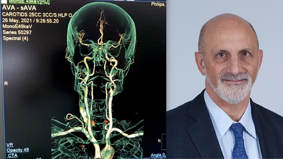 Ken Rosenfield, MD, Mass General Hospital, explains the impact wider CMS reimbursement for carotid artery stenting will have on patient stroke care and interventional cardiology. CAS