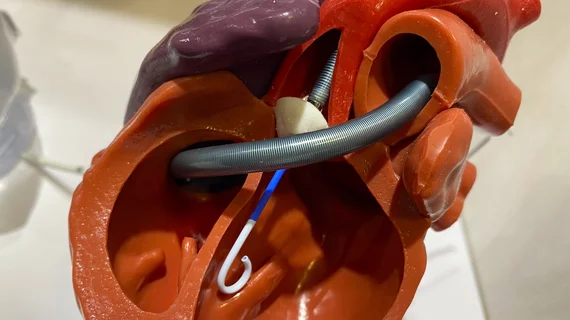 Heart model showing biventricular hemodynamic support using the Abiomed Impella CP and the Impella RP right ventricle support device. Display from TCT 2023. Photo by Dave Fornell. Johnson & Johnson MedTech Impella