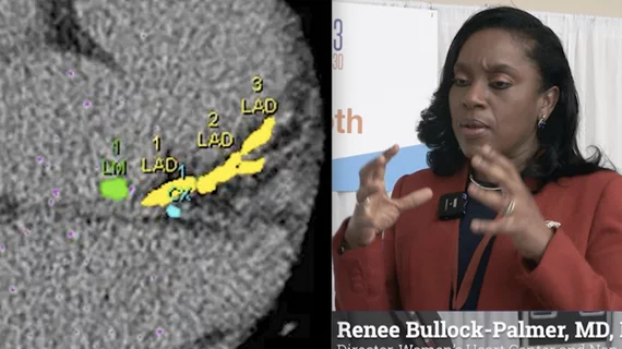 Cardiac imaging expert Renee Bullock-Palmer, MD, explains how calcium scoring can determine if patients need to be on statins or not.