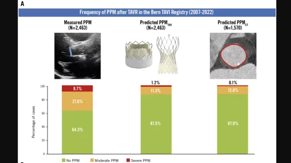 The Bern TAVI Registry looked at 2,500 TAVR patients to determine the level of prosthesis-patient mismatch (PPM) using transthoracic echocardiography (TTE), predicting PPM based one the size of the valve used, or using CT measurements of the aortic annulus to see which was method was most accurate at predicting PPM. Image courtesy of Tomii et al. 