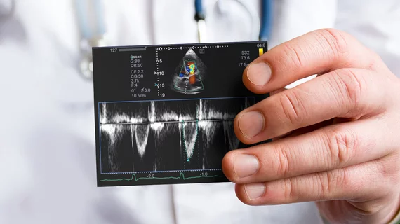 sonographer echo