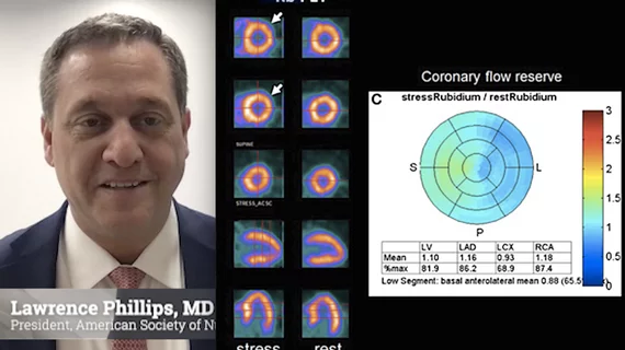 Video interview with ASNC President Lawrence Phillips, MD, NYU, who is encouraging the modernization of nuclear cardiology labs and expansion into new diagnostic areas.