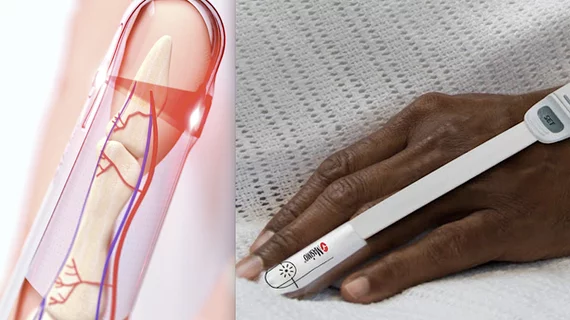 Multiple factors can interfere with pulse oximetry accuracy including skin pigmentation. Multiple studies have shown the inaccuracy of current pulse oximeters in patients with darker skin tones than whites, often over estimating their oxygenation when in fact they are hypoxic. Images courtesy of Masimo.