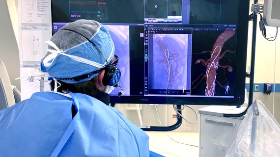 An aortic vascular surgery case being performed with the Philips LumiGuide FORS system. The light-based technology enables catheter navigation and the ability to see the catheters in multiple views with out the need for X-ray imaging in the cath lab.