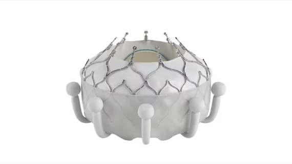 FDA approved the first transcatheter tricuspid valve (TTVR) replacement device in February 2024, the EVOQUE system from Edwards Lifesciences. The Evoque is the first transcatheter tricuspid valve approved by the FDA. The Evoke the first transcatheter tricuspid cleared in the United States.