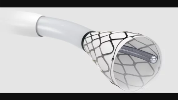 Hēlo PE Thrombectomy System developed by U.S. medical device company Endovascular Engineering.
