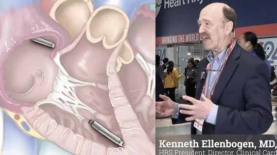 Heart Rhythm Socity (HRS) President Kenneth Ellenbogen, MD, explains key electrophysiology (EP) trends at the HRS 2024 meeting. #HRS #HRS24 #HRS2024 #EPeeps