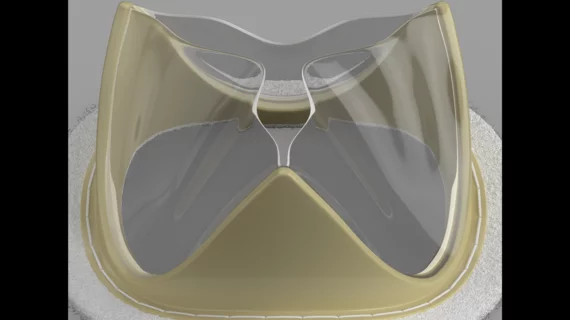 The Tria surgical mitral valve is built using LifePolymer, a proprietary material that does not include animal tissue. Both the frame of the valve and its leaflets are generated by computer to match each patient’s native mitral valve. According to Foldax, this new-look polymer reduces the long-term risk of valve calcification, and patients should be able to bounce back after surgery without requiring the long-time use of anticoagulants. 