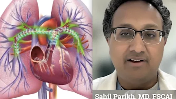 Video interview with Sahil Parikh, MD, FSCAI, director of endovascular services, New York-Presbyterian Columbia University Irving Medical Center and associate professor of medicine at Columbia University, who discusses the disparities in PE treatments in the REAL-PE study