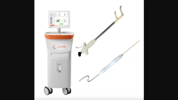 The Pulse Biosciences nanosecond PFA pulsed field ablation system.