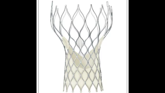 Medtronic CoreValve TAVR first-generation transcatheter heart valve