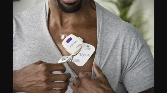 Huxley Medical, an Atlanta-based medical device company, has secured U.S. Food and Drug Administration (FDA) clearance for its new Sansa device, a chest-worn patch designed to help diagnose sleep apnea in addition to tracking patient data with electrocardiograms (ECGs) and a variety of sensors. 