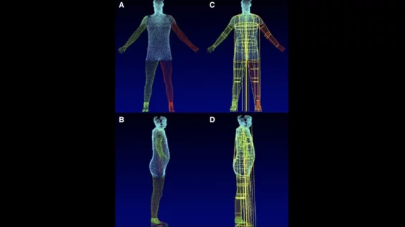 Researchers have found that an unexpected combination—artificial intelligence (AI) and a 3D body scanner—can evaluate a person’s metabolic health and identify significant risks of cardiovascular disease, diabetes and other adverse outcomes. In fact, the technique may prove to be more accurate than knowing a person’s body mass index (BMI) or waist-to-hip ratio. 