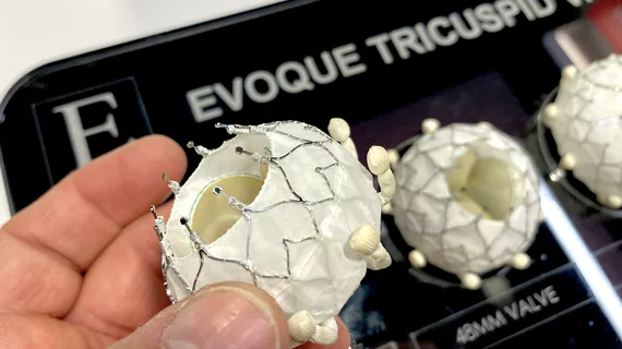 Treating severe tricuspid regurgitation (TR) with the Evoque transcatheter tricuspid valve replacement (TTVR) system from Edwards Lifesciences is associated with significant improvements in symptoms and quality of life (QOL) after one year, according to new data presented at TCT 2024 in Washington, D.C. 
