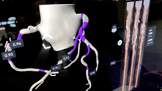HeartFlow Plaque analysis AI software highlighting areas of interest in the coronaries with significant plaque burden and showing a cross sectional reformatted view with plaques. Demo at TCT 2024. DF