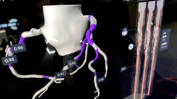 HeartFlow Plaque analysis AI software highlighting areas of interest in the coronaries with significant plaque burden and showing a cross sectional reformatted view with plaques. Demo at TCT 2024. DF