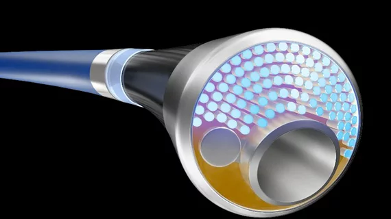 Philips Healthcare's combined IVL and laser atherectomy catheter that is being used in the THOR trial to treat heavily calcified peripheral artery lesions.