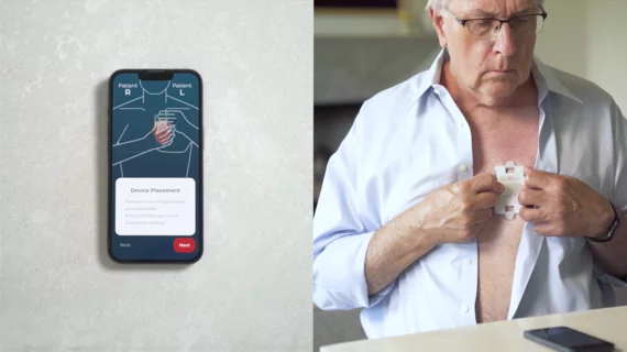 HeartBeam, a California-based healthcare technology company, has received U.S. Food and Drug Administration (FDA) clearance for its cable-free, credit card-sized heart monitor that produces 12-lead electrocardiograms (ECGs). 