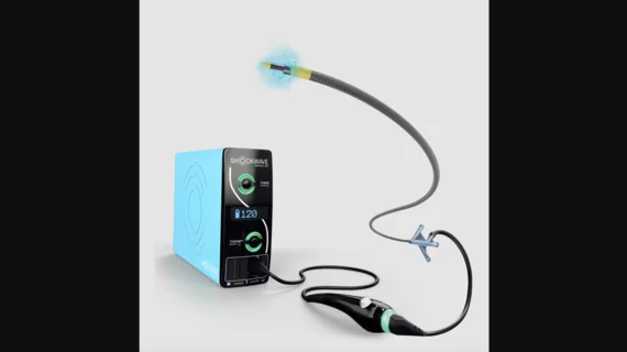 Shockwave Medical Javelin Peripheral IVL Catheter