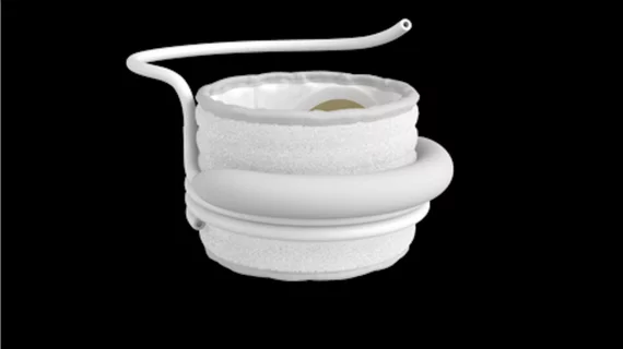 The Sapien M3 system for transcatheter mitral valve replacement using femoral access. Image courtesy of Edwards Lifesciences.