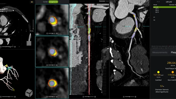 cvi42 | Plaque Circle Cardiovascular Imaging