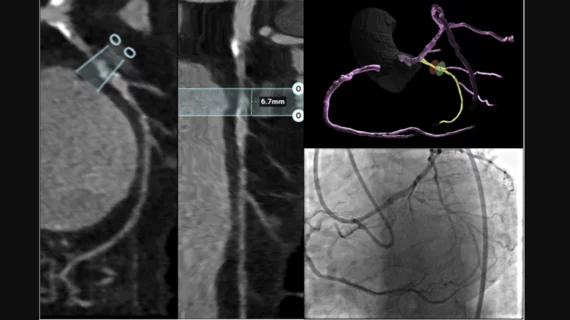 Computed Tomography | Cardiovascular Business