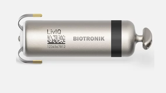  Biotronik's LivIQ leadless pacemaker offers a single-device solution designed to deliver atrioventricular (AV) synchrony through advanced electrical atrial far-field sensing. 