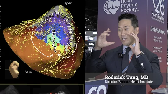 Roderick Tung, MD, FACC, FHRS, tenured professor of medicine, chief of cardiology, University of Arizona College of Medicine, director, Banner Heart Institute, explained new technology opportunities in ventricular ablation.