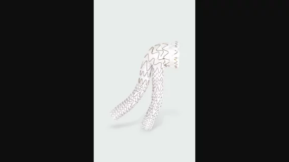 Gore Excluder Conformable AAA Endoprosthesis
