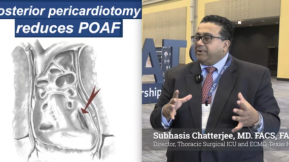 Subhasis Chatterjee, MD, FACS, FACC, FCCP, Associate Professor of Surgery, Director Thoracic Surgical ICU and ECMO Program, Baylor St. Lukes, explains the new 2026 guidelines for management of new onset post-operative atrial fibrillation (AFib), which he spoke about at the American Association for Thoracic Surgery (AATS) 2026 annual meeting. 
