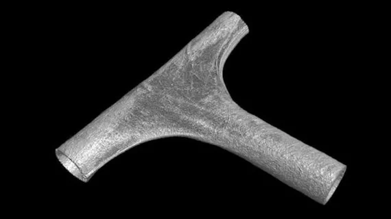 Bioengineers from Harvard have developed a new way to craft custom synthetic vascular grafts in a matter of a minutes. The group shared its findings in Advanced Materials, highlighting the potential to provide on-demand care for patients in need.