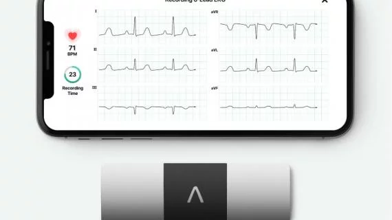 The AliveCor KardiaMobile 6-lead ECG remote monitoring system.