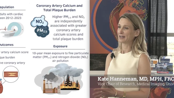 Video of Kate Hanneman, MD, MPH, FRCPC, associate professor and vice chair of research, Department of Medical Imaging, University of Toronto, and a cardiac radiologist with the Joint Department of Medical Imaging, explaining a recent CCTA study that showed higher air pollution levels correlates with higher rates of cardiovascular disease.
