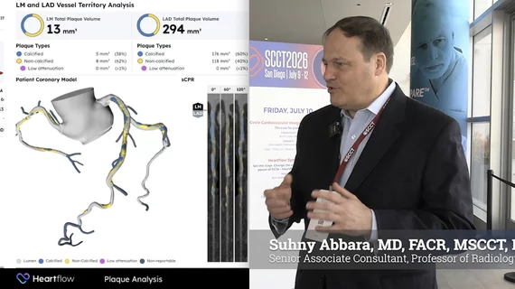 Suhny Abbara, MD, FACR, MSCCT, FNASCI, senior associate consultant and professor of radiology, Mayo Clinic, Jacksonville, Florida, and editor of the RSNA journal Radiology, explains some of the advances in cardiac CT radiologists should be paying attention to. 
