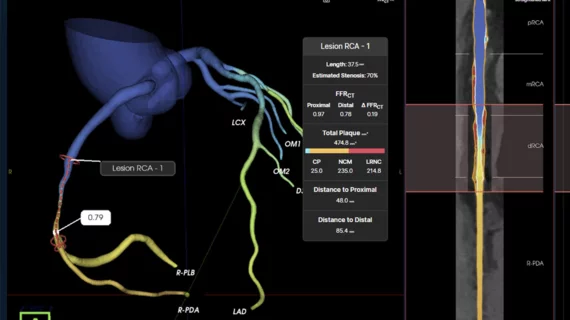 The U.S. Food and Drug Administration (FDA) granted 510(k) clearance for Elucid's FFR-IQ software for the noninvasive estimation of fractional flow reserve from coronary CT angiography (FFR-CT). The artificial intelligence (AI) based technology incorporates coronary anatomy and plaque composition into its estimation of coronary physiology for a more accurate and individualized assessment to aid in treatment decisions.