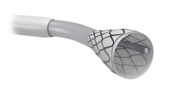 Endovascular Engineering's Hēlo Thrombectomy System to treat pulmonary embolism was granted U.S. FDA approval.