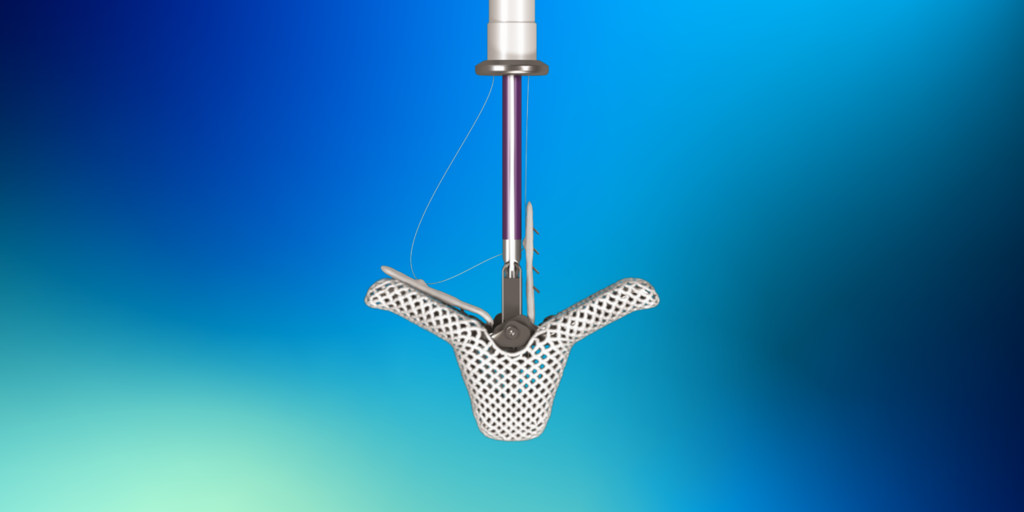 Abbott gathering real-world data on FDA-approved TriClip system