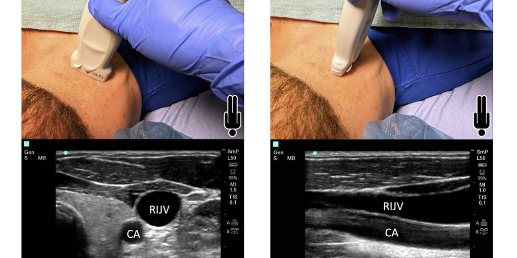 【残りわずか】 for guidelines new shares ASE ultrasound-guided access vascular マジック：ザ・ギャザリング