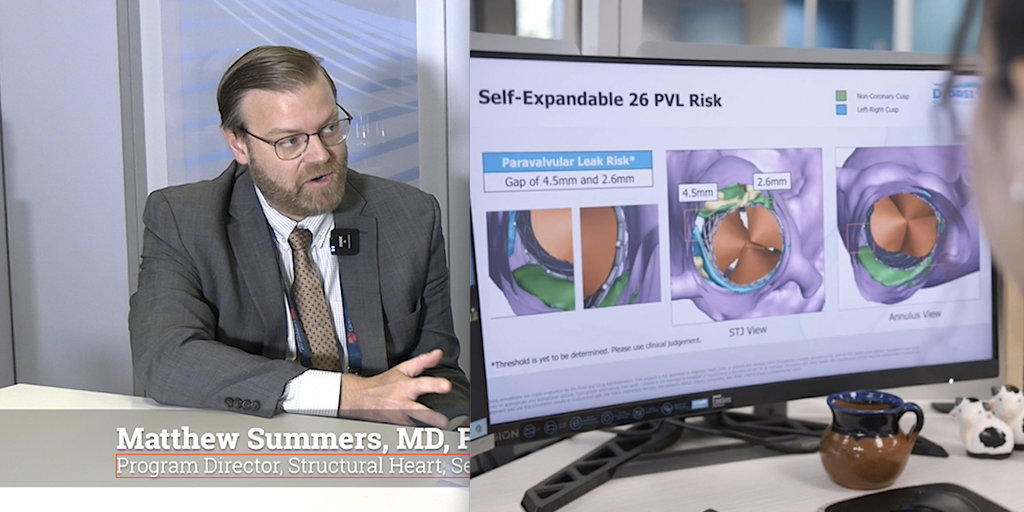 3D software helps cardiologists plan ahead for TAVR complications