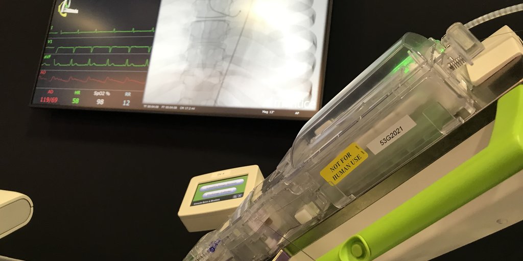 Siemens Healthineers receives up to $31M to develop autonomous robot for remote stroke treatments
